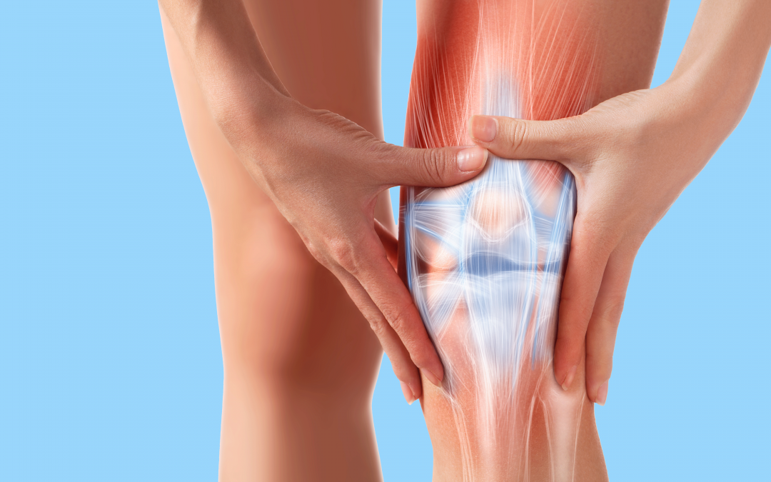 What is Patellar Syndrome?