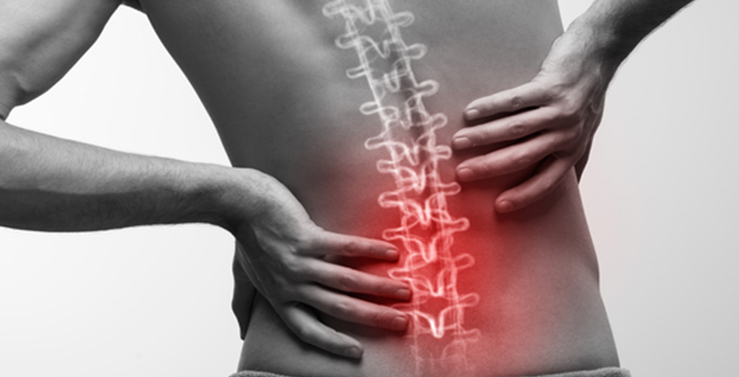 Sciatica Pain - Interventional Pain Management in New Jersey