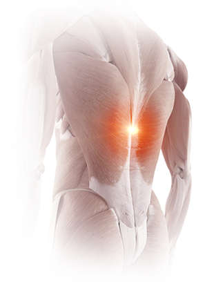 What is Lumbar RFA – Pain Treatment Specialists