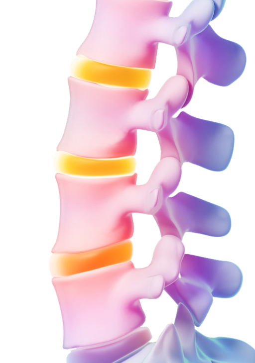 Mask Group 18(1) What is Lumbar RFA – Pain Treatment Specialists