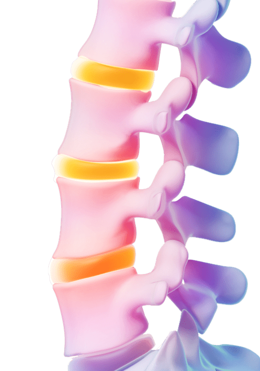 Mask-Group-181 What is Lumbar RFA – Pain Treatment Specialists