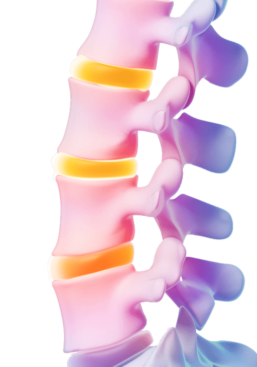 What is Lumbar RFA – Pain Treatment Specialists