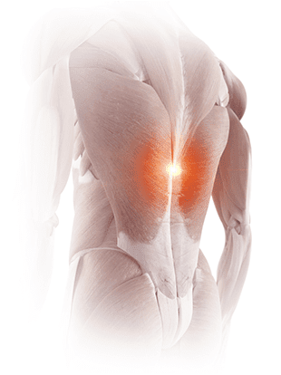 back pain treated with RFA