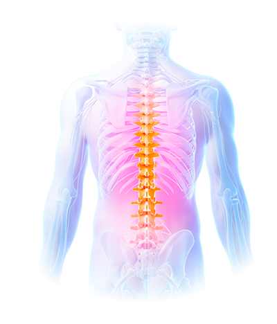 Back pain due to Lumbar Herniated Discs