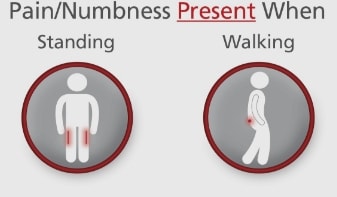 Numbness-present-when