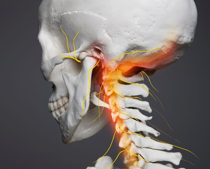 Neck injuries as whiplash pic