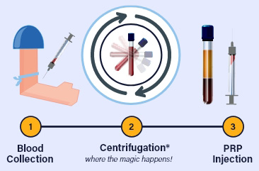 procedure-steps-2 procedure-steps-2