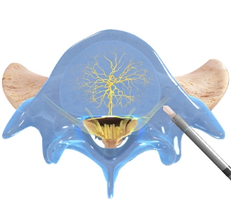 Access the Pedicle