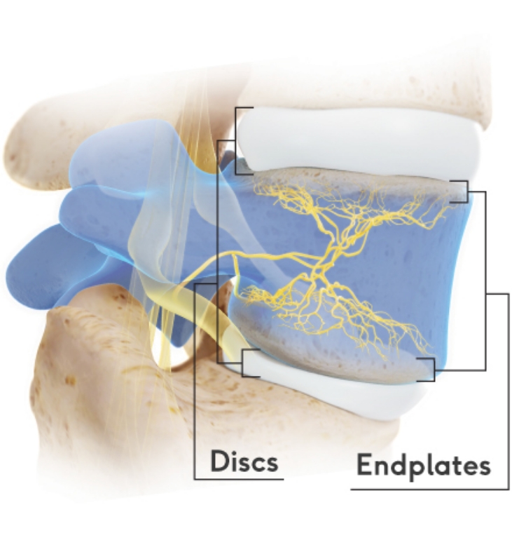 disks-endplates