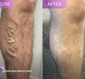 Explore holistic pain relief strategies and minimally invasive pain treatments at Pain Treatment Specialists. From acupuncture to physical therapy, find relief today!