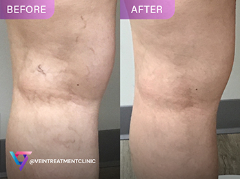 We offer expert tips for navigating the healthcare system for pain management. Learn about pain treatments, lifestyle changes, and more at Pain Treatment Specialists.